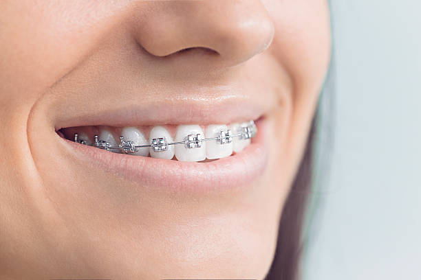 Best Invisalign and Clear Aligners  in Midland, WA